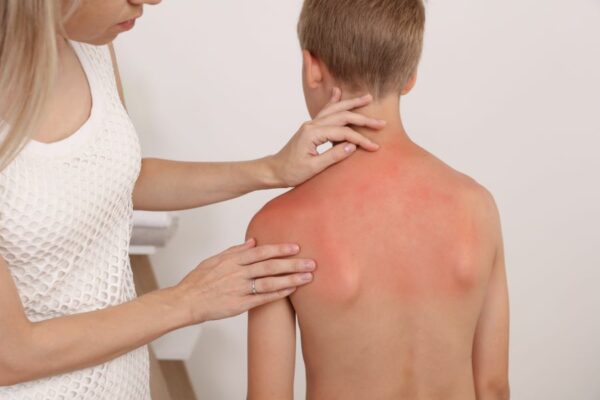 how-to-treat-heat-related-illnesses-in-children-nabtahealth-women-s