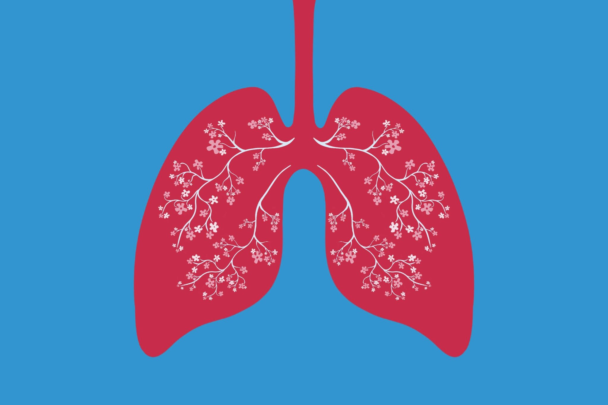 Lung disease in premature infants