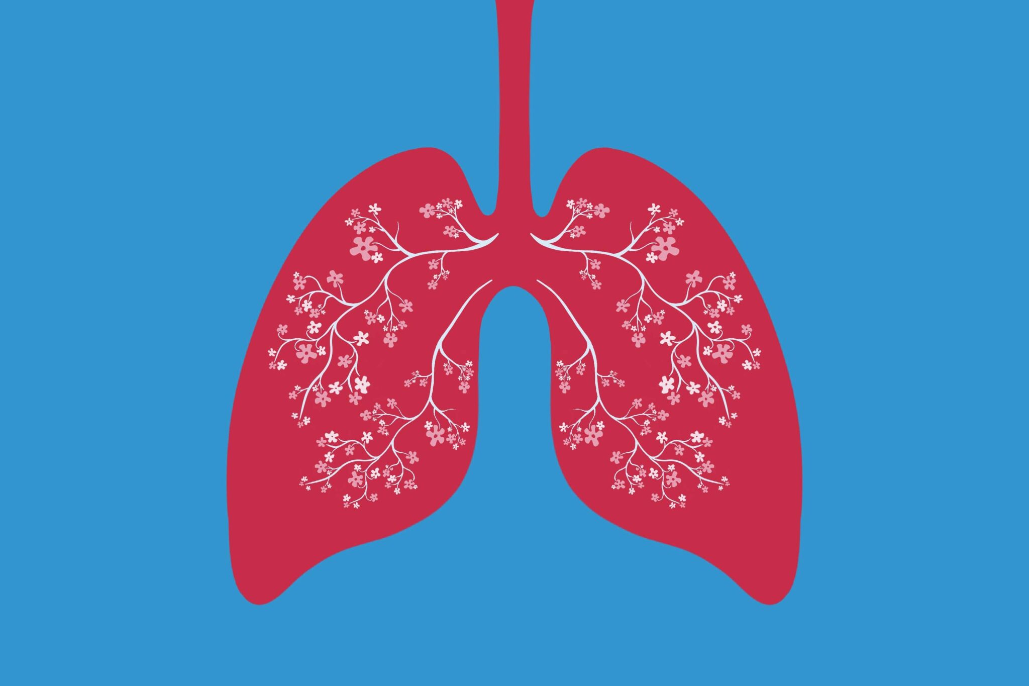 Lung Disease in Premature Infants - Nabta Health