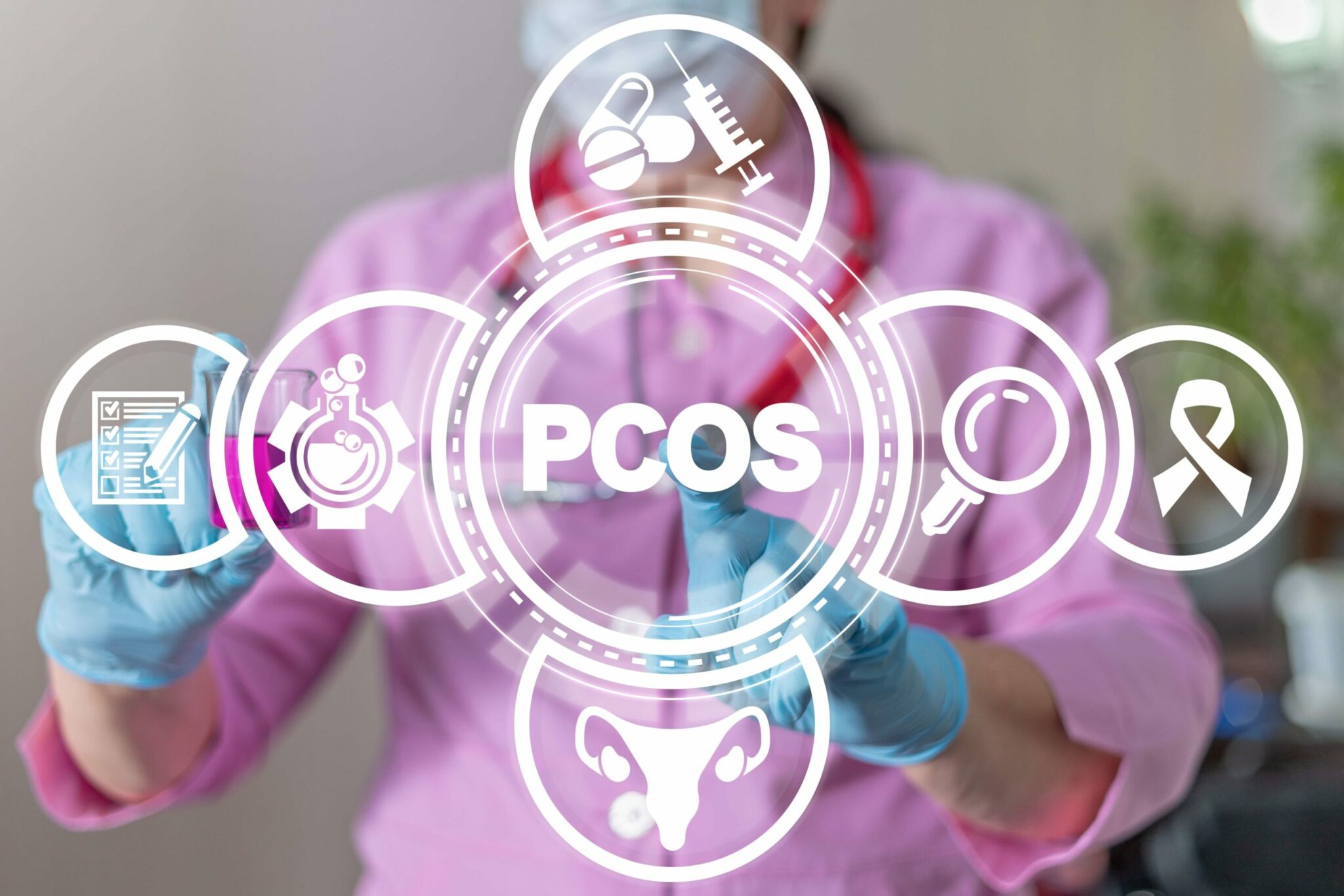 What is PCOS