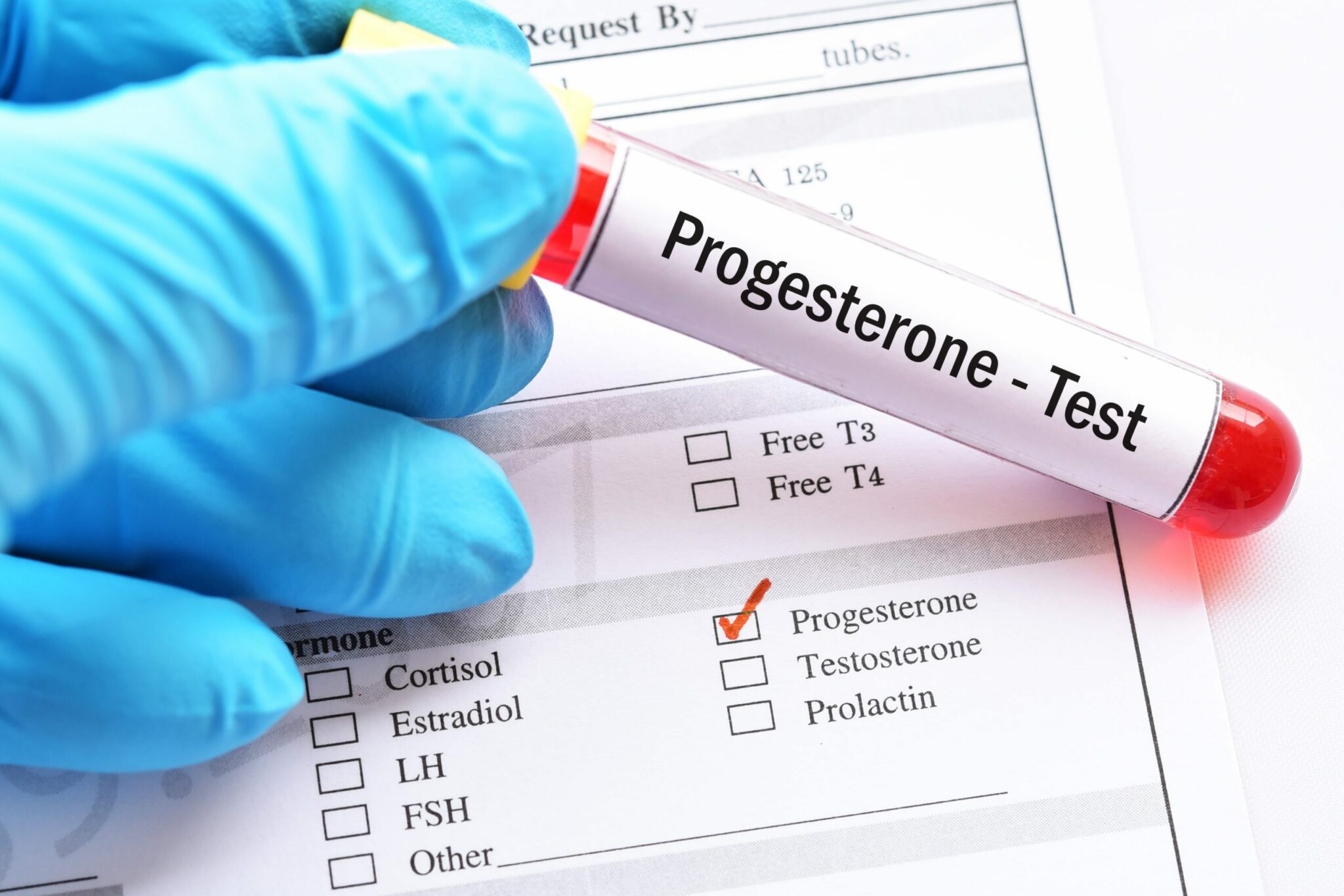 low progesterone level